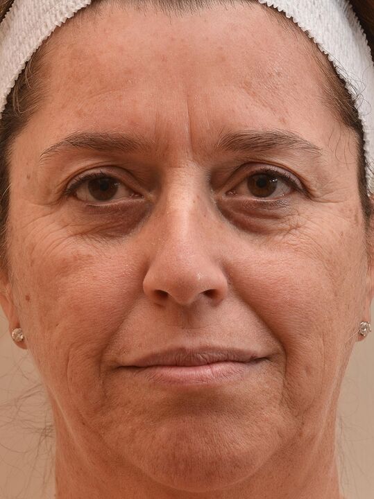 Затова погледнах преди да използвам Eudalie Cream