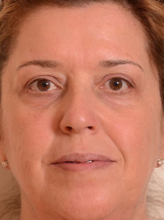 Подмладих лицето си с крем Eudalie